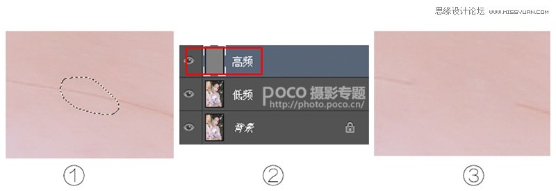 巧用PS高低頻工具去除人像面部的發(fā)絲